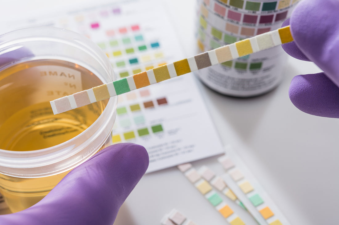 Positive Dip Stick Urine Test.....What Does It Mean?